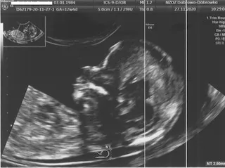 Certyfikat Fetal Medicine Foundation FMF London — lek. med. Jowita Hrycyna